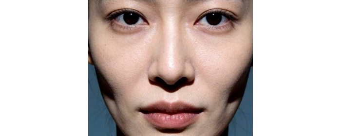 脸颊凹陷是福是祸？