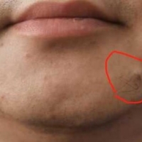 请问这个痣有什么说法吗？