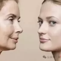 法令纹是不是意味着衰老？