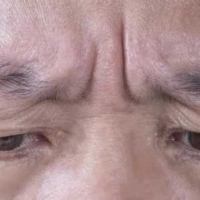 从面相就能看出你的健康状况