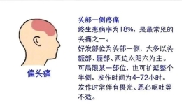 图解不同部位的头痛