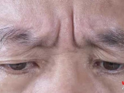 从面相就能看出你的健康状况