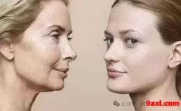 法令纹是不是意味着衰老？