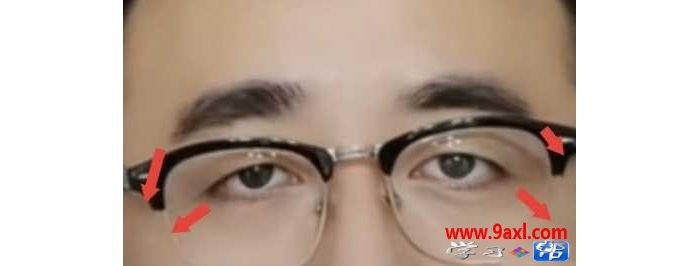 四尾低垂，就是眉尾和眼尾均下垂