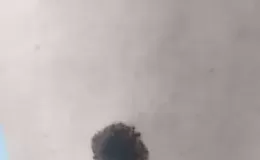 网上看到的身上的痣