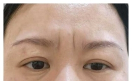 眉间有川字纹