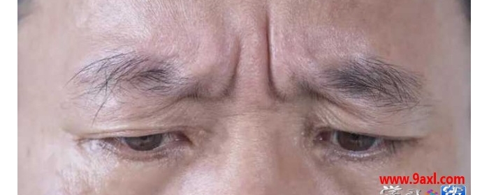 从面相就能看出你的健康状况