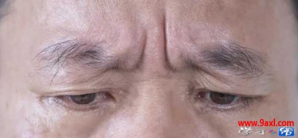 从面相就能看出你的健康状况