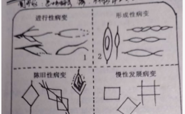 手掌纹理形符病象性质